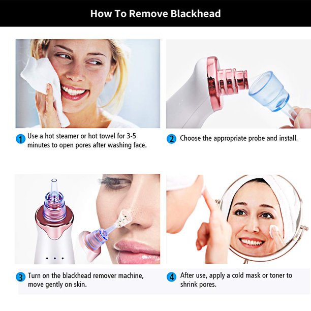 AKEDRE Blackhead Remover Vacuum,Upgraded Facial Pore Cleaner,Electric Acne Comedone Whitehead Extractor Tool-5 Suction Power,USB Rechargeable Blackhead Vacuum Kit for Women & Men